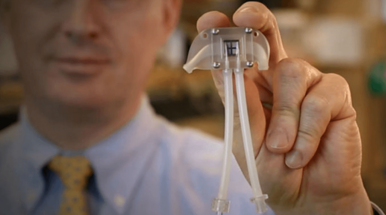 Cientistas inventam “rim biônico”