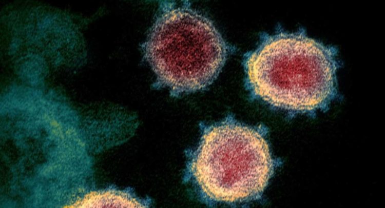 Japão confirma 293 novos casos de COVID-19 na segunda-feira