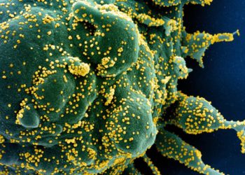 Japão registra 657 casos de COVID-19 na quinta-feira