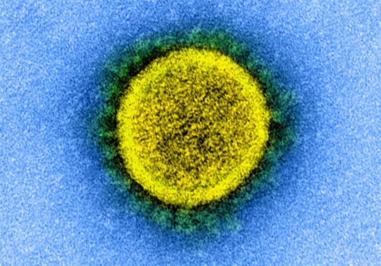 Japão registra 485 casos de COVID-19 na quinta-feira