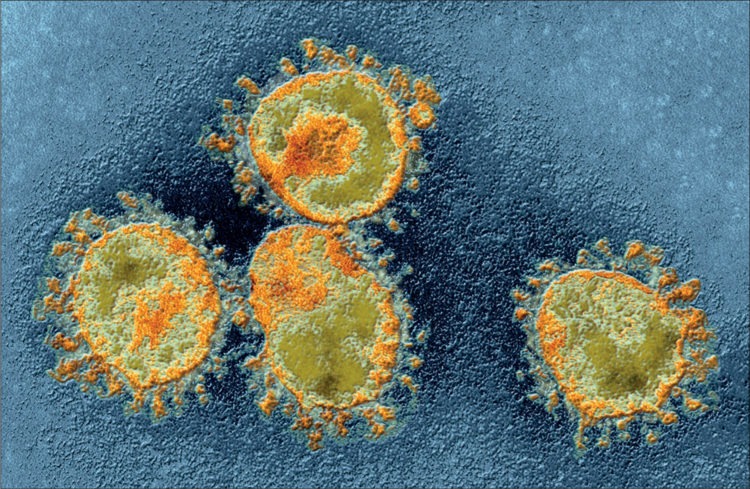 Japão registra 500 casos de COVID-19 na terça-feira