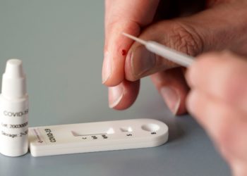 Governo de Tóquio anuncia que aumentará capacidade de testes PCR por dia para cerca de 68 mil