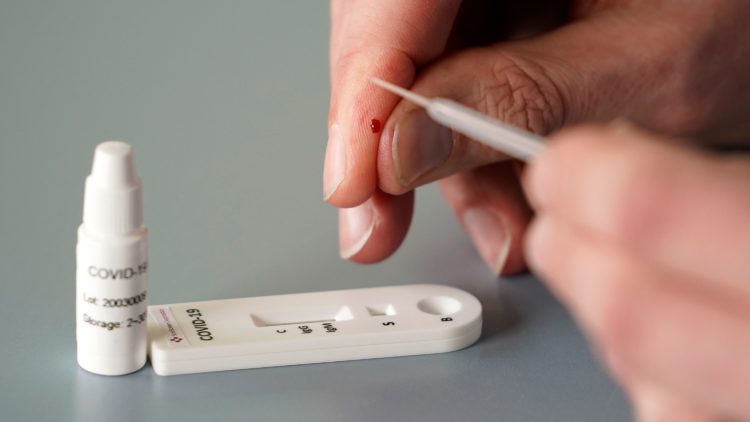 Governo de Tóquio anuncia que aumentará capacidade de testes PCR por dia para cerca de 68 mil