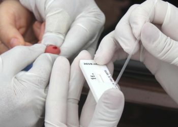 Kit de teste que detecta um dos sintomas do coronavírus é desenvolvido por Pesquisadores