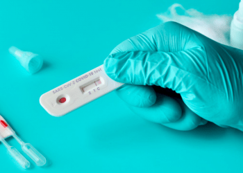 Governo estuda aprovar a venda limitada de kits de teste da Covid-19 online