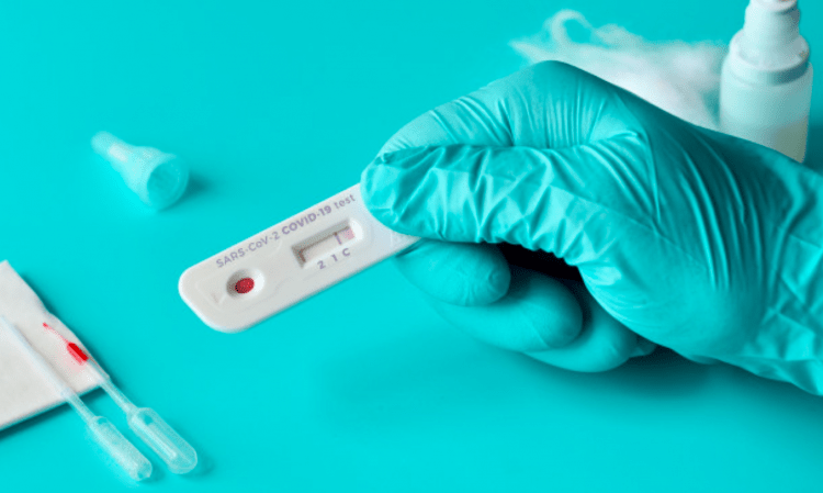 Governo estuda aprovar a venda limitada de kits de teste da Covid-19 online