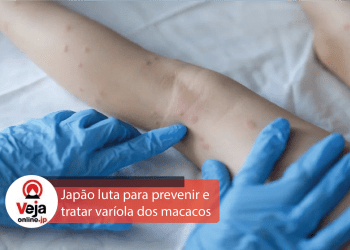 Japão se esforça para prevenir e tratar varíola dos macacos