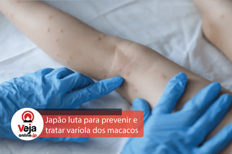 Japão se esforça para prevenir e tratar varíola dos macacos