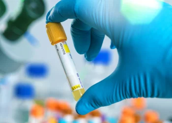 Japão registra a primeira morte de criança por hepatite aguda de causa desconhecida