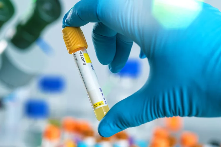 Japão registra a primeira morte de criança por hepatite aguda de causa desconhecida