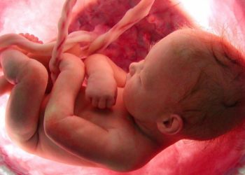 Japão planeja realizar transplante de rim de porco em feto