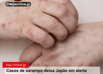 Casos de sarampo deixa Japão em alerta