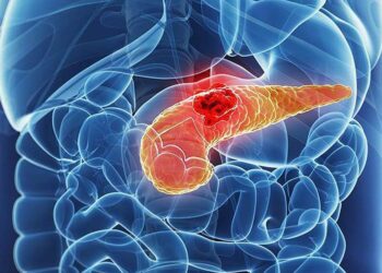 Universidade de Osaka desenvolve novo método para detectar câncer de pâncreas