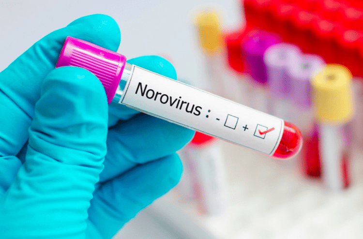 Norovírus contamina mais de 80 pessoas em escola primária