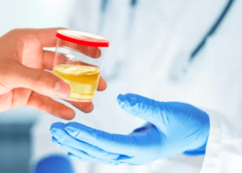 Empresa japonesa cria teste de urina para detectar câncer precoce