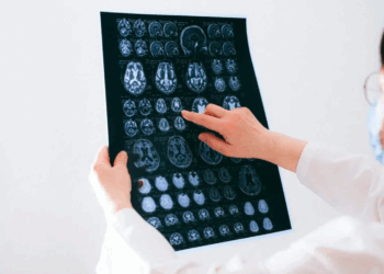 Estudo japonês identifica possível causa da “névoa cerebral” pós-Covid