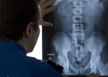 Casal brasileiro é preso em Osaka por contrabandear cocaína ingerida em cápsulas