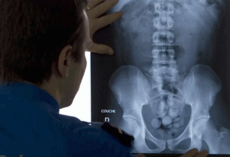 Casal brasileiro é preso em Osaka por contrabandear cocaína ingerida em cápsulas