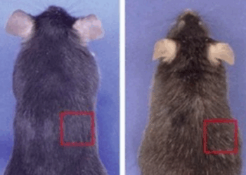 Estudo japonês aponta que cabelos brancos podem ser mecanismo natural de defesa contra o câncer