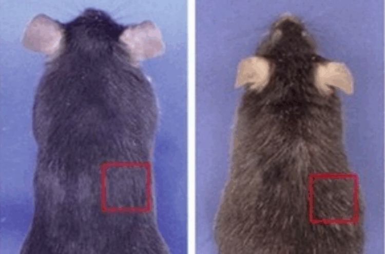 Estudo japonês aponta que cabelos brancos podem ser mecanismo natural de defesa contra o câncer