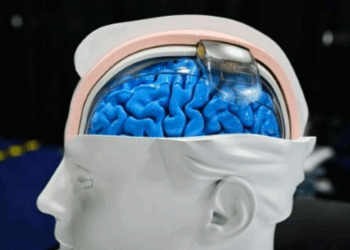 Neurotecnologia avança rapidamente, promete transformar a medicina e acende alertas éticos globais