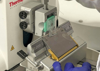 Córnea artificial de escamas de peixe pode revolucionar transplantes