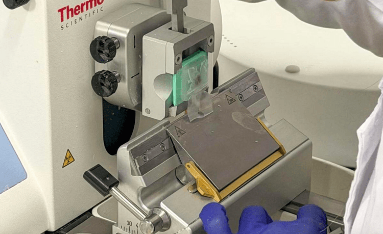 Córnea artificial de escamas de peixe pode revolucionar transplantes